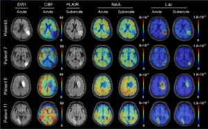 ISMRM2021-005459_Fig3.png