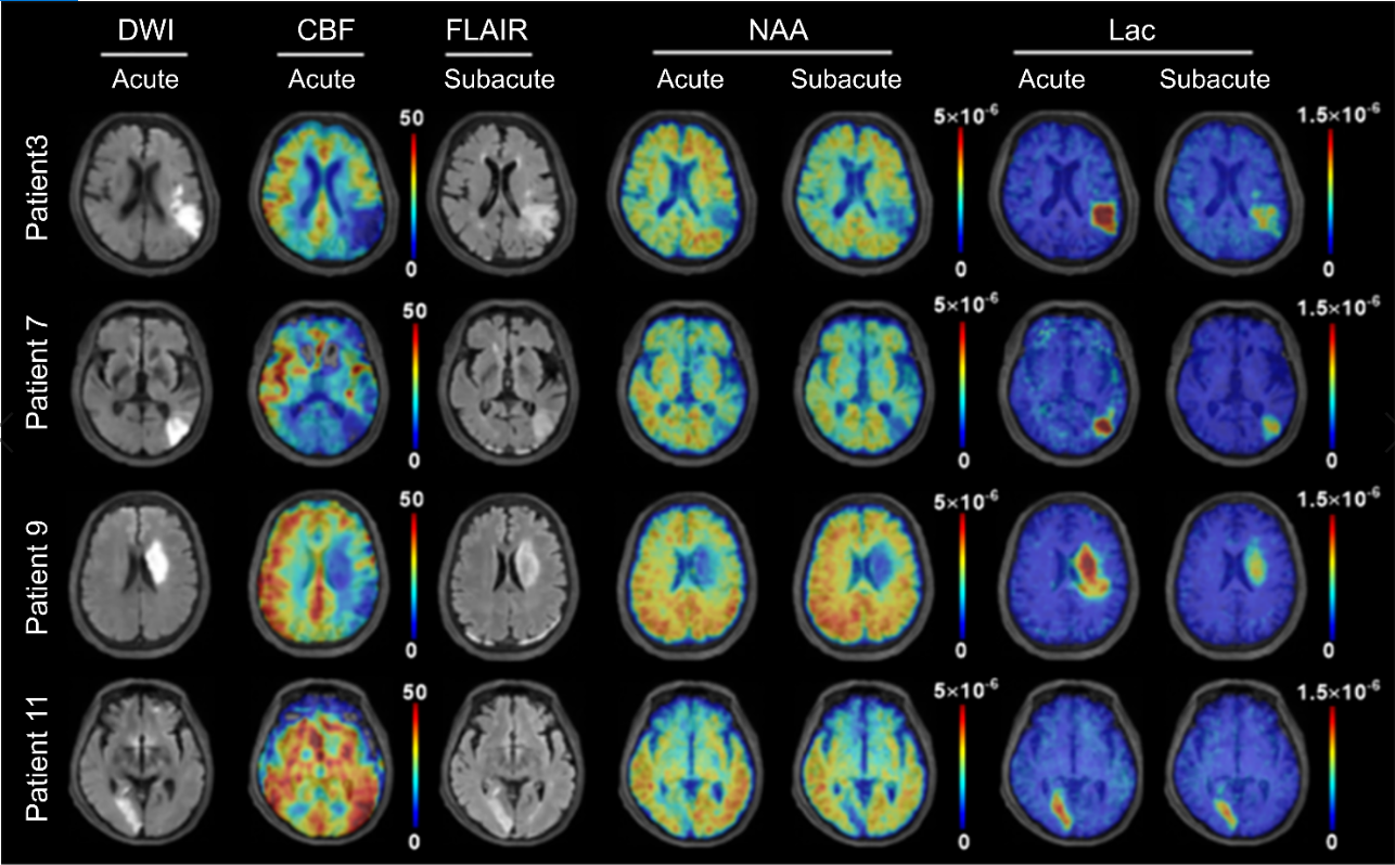 ISMRM2021-005459_Fig3.png